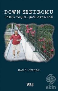 Down Sendromu