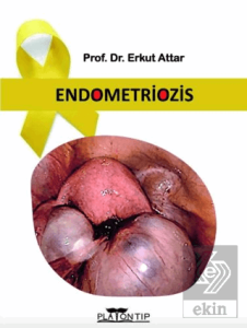 Endometriozis