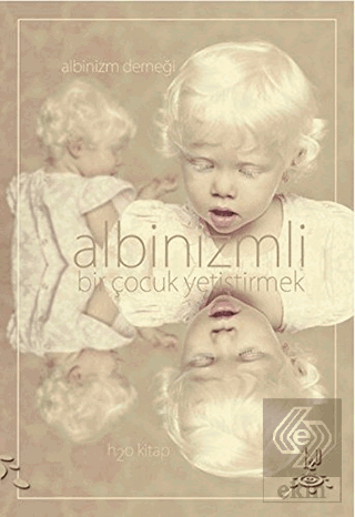 Albinizmli Bir Çocuk Yetiştirmek