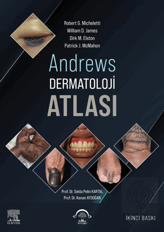 Andrews Dermatoloji Atlası
