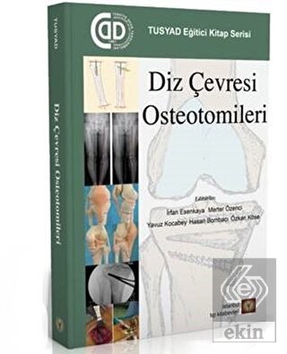 Diz Çevresi Osteotomileri