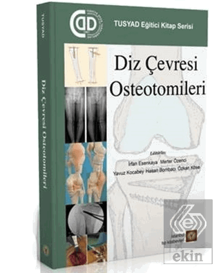 Diz Çevresi Osteotomileri