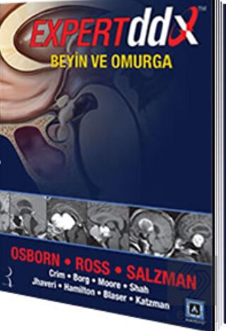 Expert DDX: Beyin ve Omurga