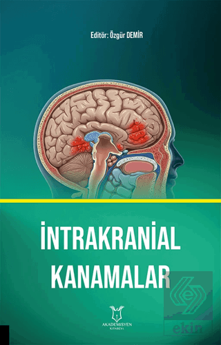 İntrakranial Kanamalar
