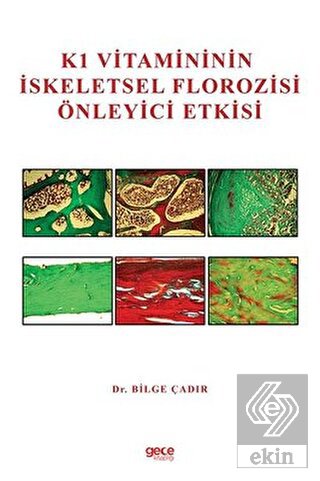 K1 Vitamininin İskeletsel Florozisi Önleyici Etkis
