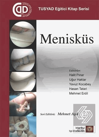 Menisküs