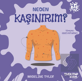 Neden Kaşınırım?