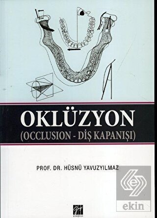 Oklüzyon