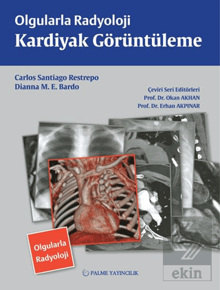 OLGULARLA RADYOLOJİ KARDİYAK GÖRÜNTÜLEME (PALME)