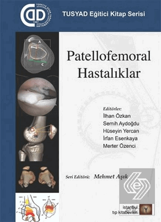 Patellofemoral Hastalıklar