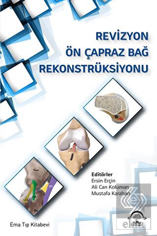 Revizyon Ön Çapraz Bağ Rekonstrüksiyonu